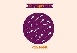 Oligospermia