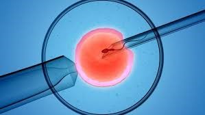 In Vitro Fertilization